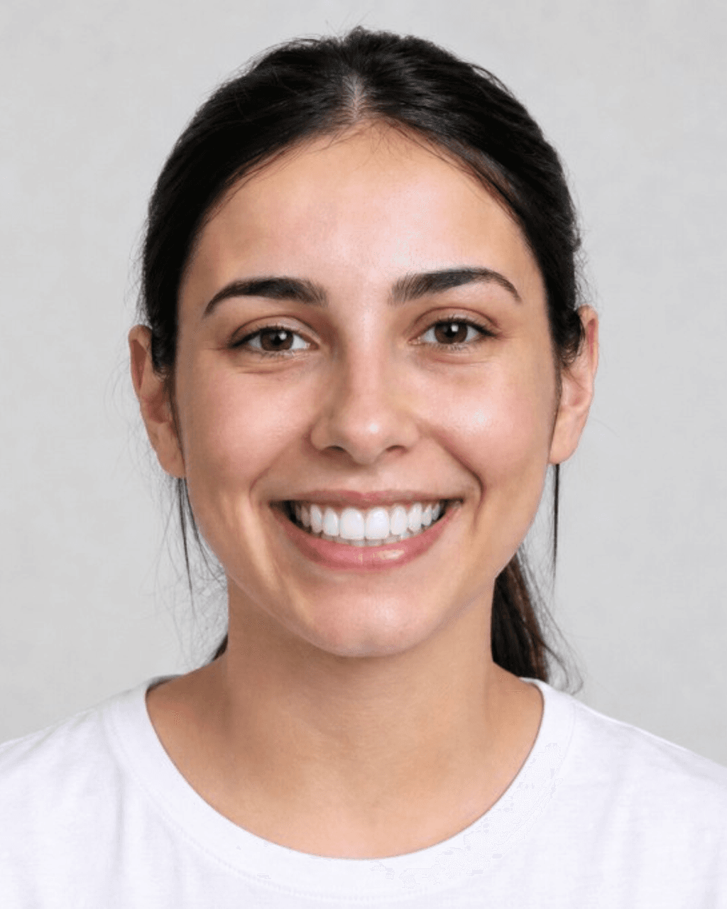 After — Single-tooth implant restoration