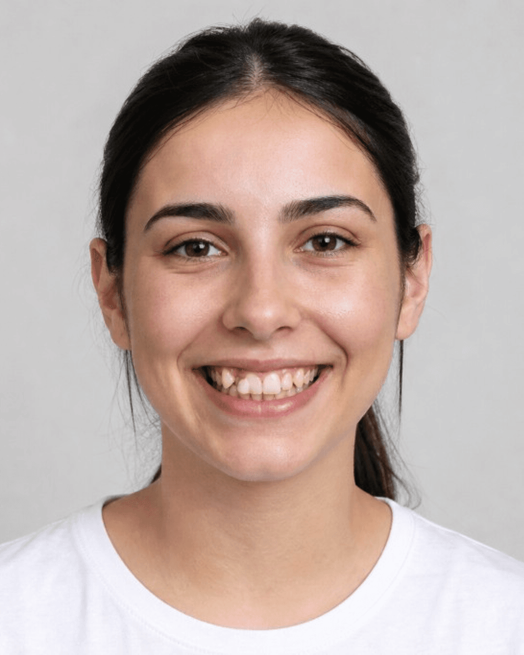 Before — Single-tooth implant restoration